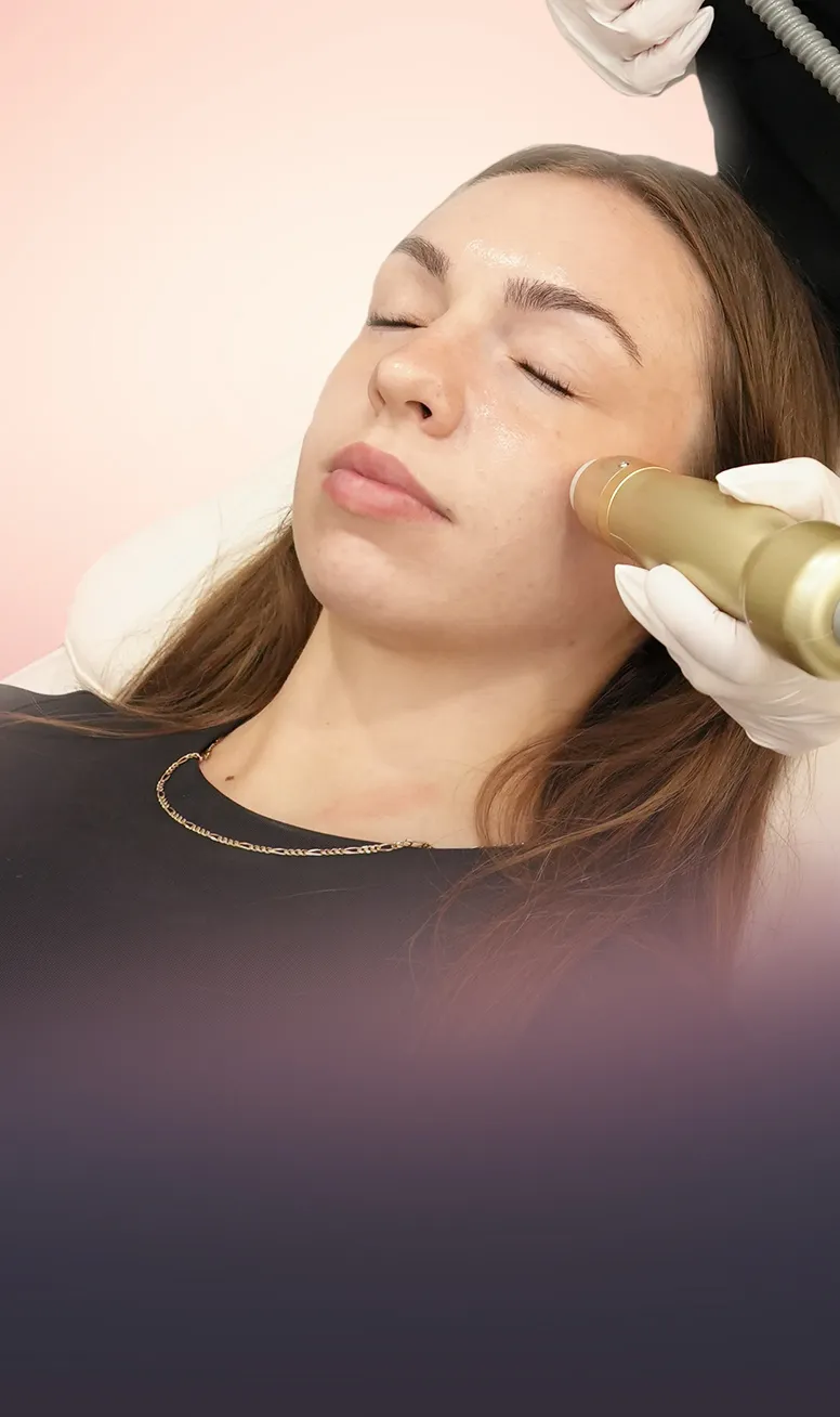 Sylfirm X RF Microneedling (Face) treatment at Toronto medical spa